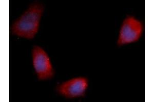 Immunofluorescence (IF) image for anti-Fibroblast Growth Factor 12 (FGF12) (AA 1-181) antibody (PE) (ABIN5565468) (FGF12 抗体  (AA 1-181) (PE))