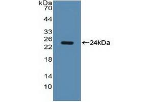 WB of Protein Standard: different control antibodies against Highly purified E. (Nucleolin ELISA 试剂盒)