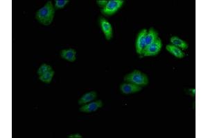 Immunofluorescence staining of HepG2 cells with ABIN7169938 at 1:100, counter-stained with DAPI. (SCN4B 抗体  (AA 31-162))