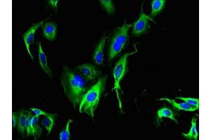 Immunofluorescent analysis of Hela cells using ABIN7147035 at dilution of 1:100 and Alexa Fluor 488-congugated AffiniPure Goat Anti-Rabbit IgG(H+L) (CATSPER4 抗体  (AA 306-472))