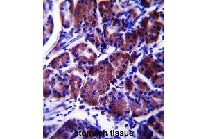Immunohistochemistry (IHC) image for anti-Lysophospholipase Protein 1 (LYPL1) antibody (ABIN2997640) (LYPL1 抗体)