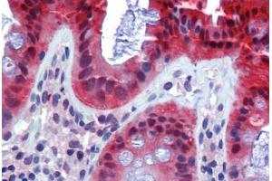 Human Colon (formalin-fixed, paraffin-embedded) stained with CASP7 antibody ABIN462356 followed by biotinylated anti-mouse IgG secondary antibody ABIN481714, alkaline phosphatase-streptavidin and chromogen. (Caspase 7 抗体)