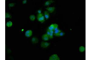 Immunofluorescence staining of MCF-7 cells with ABIN7150380 at 1:200, counter-stained with DAPI. (RFX2 抗体  (AA 1-130))