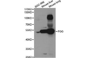 Western blot analysis of extracts of various cell lines, using FGG antibody (ABIN5973288) at 1/1000 dilution. (FGG 抗体)