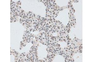 Immunohistochemistry of paraffin-embedded Rat lung using ZNF148 Polyclonal Antibody at dilution of 1:100 (40x lens). (ZNF148 抗体)
