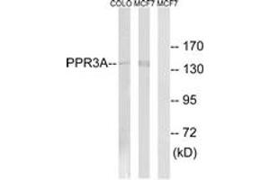 Western Blotting (WB) image for anti-Protein Phosphatase 1, Regulatory Subunit 3A (PPP1R3A) (AA 647-696) antibody (ABIN2890542) (PPP1R3A 抗体  (AA 647-696))