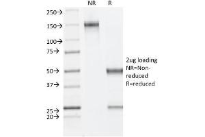 SDS-PAGE Analysis Purified ER-beta Mouse Monoclonal Antibody (ESR2/686). (ESR2 抗体  (C-Term))