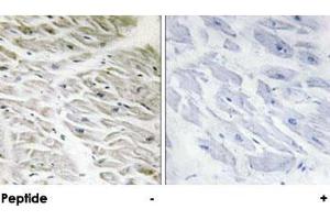 Immunohistochemical analysis of paraffin-embedded human heart tissue using PPP1R14A polyclonal antibody . (CPI-17 抗体)