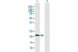 Western Blot analysis of FKBP11 expression in transfected 293T cell line by FKBP11 MaxPab polyclonal antibody. (FKBP11 抗体  (AA 1-201))