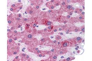 HGF antibody was used for immunohistochemistry at a concentration of 4-8 ug/ml. (HGF 抗体)