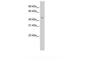 Image no. 2 for anti-E74-Like Factor 3 (Ets Domain Transcription Factor, Epithelial-Specific) (ELF3) (N-Term) antibody (ABIN6736320)