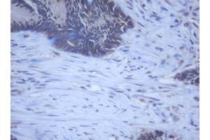 Image no. 10 for anti-DEAD (Asp-Glu-Ala-Asp) Box Polypeptide 59 (DDX59) (AA 1-303) antibody (ABIN1490728)