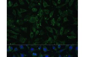 Immunofluorescence analysis of L929 cells using APH1A Polyclonal Antibody at dilution of 1:100 (40x lens). (APH1A 抗体)