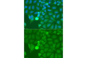 Immunofluorescence analysis of A549 cells using IRAK2 antibody (ABIN5975418). (IRAK2 抗体)