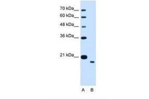 Image no. 1 for anti-Transmembrane Protein 91 (TMEM91) (AA 51-100) antibody (ABIN341306) (TMEM91 抗体  (AA 51-100))
