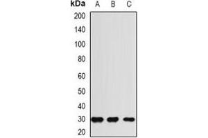 Western blot analysis of RGR expression in HEK293T (A), mouse liver (B), rat heart (C) whole cell lysates. (RGR 抗体)