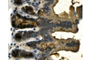 IHC analysis of Galectin 2/LGALS2 using anti-Galectin 2/LGALS2 antibody (ABIN7598979).