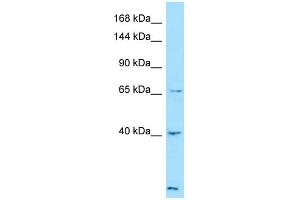 Western Blotting (WB) image for anti-Latent Transforming Growth Factor beta Binding Protein 4 (LTBP4) (C-Term) antibody (ABIN2789916) (LTBP4 抗体  (C-Term))