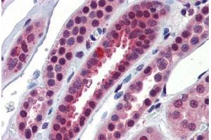 Human Kidney (formalin-fixed, paraffin-embedded) stained with NFX1 antibody ABIN462262 followed by biotinylated goat anti-rabbit IgG secondary antibody ABIN481713, alkaline phosphatase-streptavidin and chromogen. (NFX1 抗体  (C-Term))