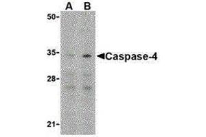 Western Blotting (WB) image for anti-Caspase 4, Apoptosis-Related Cysteine Peptidase (CASP4) (N-Term) antibody (ABIN2477914)