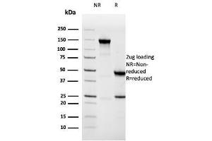 SDS-PAGE Analysis Purified Napsin A Mouse Monoclonal Antibody (NAPSA/3308). (NAPSA 抗体  (AA 189-299))