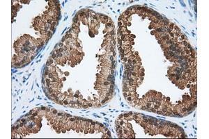 Immunohistochemistry (IHC) image for anti-Acetyl-CoA Acetyltransferase 2 (ACAT2) antibody (ABIN1496401) (ACAT2 抗体)