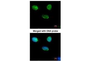 ICC/IF Image Immunofluorescence analysis of paraformaldehyde-fixed HeLa, using MCM3, antibody at 1:500 dilution. (MCM3 抗体)