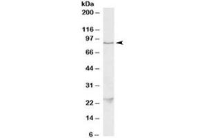 Western blot testing of HeLa lysate with TBK1 antibody at 1ug/ml. (TBK1 抗体)