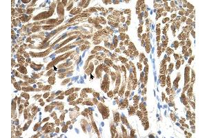 PEX10 antibody was used for immunohistochemistry at a concentration of 4-8 ug/ml to stain Skeletal muscle cells (arrows) in Human Muscle. (PEX10 抗体  (Middle Region))