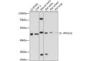 Western blot analysis of extracts of various cell lines, using PPHLN1 antibody (ABIN7269229) at 1:1000 dilution. (PPHLN1 抗体  (AA 195-255))