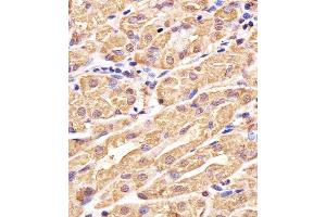 Immunohistochemical analysis of paraffin-embedded H. (Glutathione Synthetase 抗体  (C-Term))
