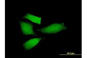 Immunofluorescence of purified MaxPab antibody to AMIGO2 on HeLa cell. (AMIGO2 抗体  (AA 1-522))