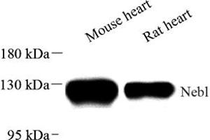 Western blot analysis of Nebulette (ABIN7074788) at dilution of 1: 2000 (Nebulette 抗体)