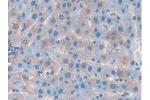 DAB staining on IHC-P; Samples: Rat Liver Tissue (RANKL 抗体  (AA 106-240))