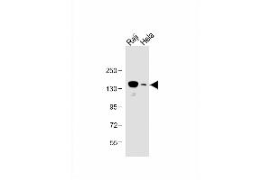 All lanes : Anti-UBE4B Antibody (N-term) at 1:1000 dilution Lane 1: Raji whole cell lysate Lane 2: Hela whole cell lysate Lysates/proteins at 20 μg per lane. (UBE4B 抗体  (N-Term))