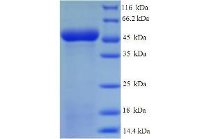 SDS-PAGE (SDS) image for CD1d Molecule (CD1D) (AA 20-301), (Extracellular) protein (His-SUMO Tag) (ABIN5709229)