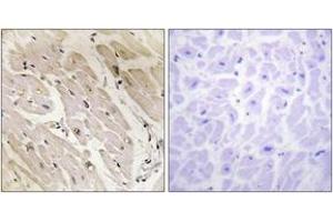 Immunohistochemistry analysis of paraffin-embedded human heart tissue, using PRKAG2 Antibody.