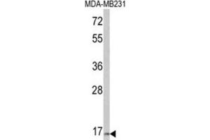 Western Blotting (WB) image for anti-Thyroid Stimulating Hormone, beta (TSHB) antibody (ABIN3003835) (TSHB 抗体)