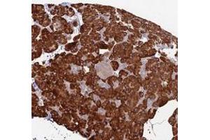 Immunohistochemical staining of human pancreas with TRAPPC6A polyclonal antibody  shows strong cytoplasmic positivity in exocrine glandular cells.