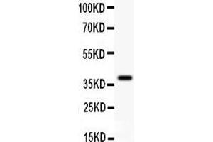 Anti- Dicer antibody, Western blotting All lanes: Anti Dicer  at 0. (DICER1 抗体  (AA 1-195))
