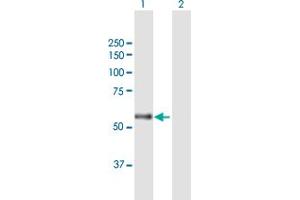 Western Blot analysis of CARD14 expression in transfected 293T cell line by CARD14 MaxPab polyclonal antibody. (CARD14 抗体  (AA 1-434))