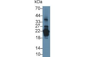 Detection of PRH2 in Human Saliva using Polyclonal Antibody to Acidic Salivary Proline Rich Phosphoprotein 2 (PRH2) (PRH2 抗体  (AA 17-166))