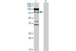 Western Blot analysis of ZNF274 expression in transfected 293T cell line by ZNF274 monoclonal antibody (M04), clone 1D8. (ZNF274 抗体  (AA 420-530))