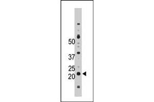 The NME4 polyclonal antibody  is used in Western blot to detect NME4 in Jurkat cell lysate. (NME4 抗体  (C-Term))