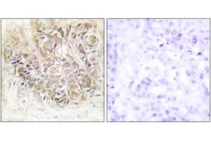 Immunohistochemistry (IHC) image for anti-Tumor Protein, Translationally-Controlled 1 (TPT1) (AA 71-120) antibody (ABIN1533616)