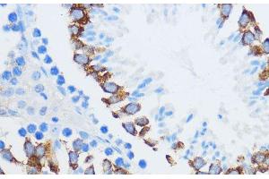 Immunohistochemistry of paraffin-embedded Mouse testis using IGF2BP3 Polyclonal Antibody at dilution of 1:100 (40x lens). (IGF2BP3 抗体)