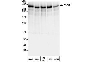 Western Blotting (WB) image for anti-Tumor Protein P53 Binding Protein 1 (TP53BP1) (AA 350-400) antibody (ABIN7453568) (TP53BP1 抗体  (AA 350-400))