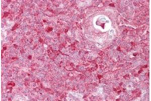 Anti-TIMELESS antibody IHC staining of human thymus. (TIMELESS 抗体  (AA 290-339))