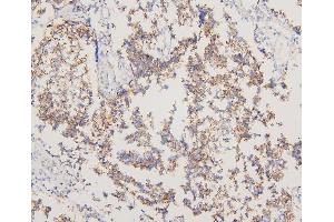 IHC analysis of EGFR using anti-EGFR antibody (ABIN5518909). (EGFR 抗体  (N-Term))