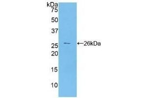 Detection of Recombinant CA125, Human using Polyclonal Antibody to Carbohydrate Antigen 125 (CA125) (MUC16 抗体  (AA 13977-14117))